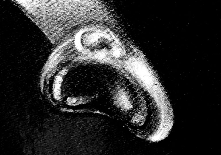 Депрессия, шизофрения и агорафобия: как выглядят распространённые психические расстройства