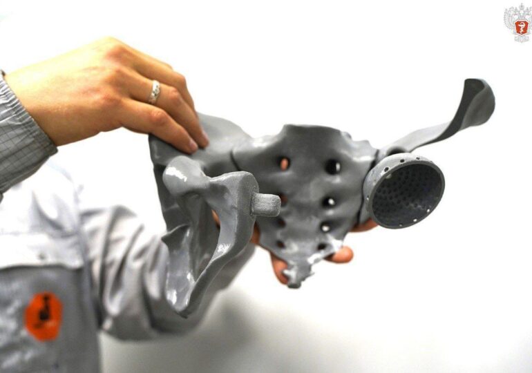 Самарские врачи успешно установили эндопротез пациенту со злокачественной опухолью